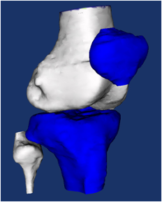 Computer Model of Knee Joint